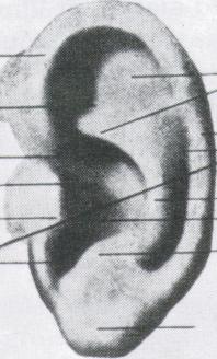 Ear of Vincent