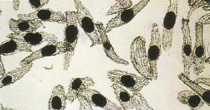 Orchid seeds are tiny, like specks of dust, each seed has a minute, ovoid embryo inside the net-like coat. Magnification x 250)