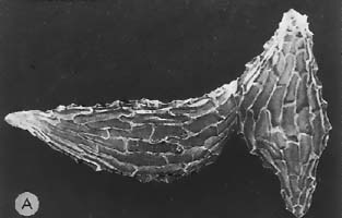 Scanning electron micrograph of seeds of Cymbidium atropurpureum - whole seeds, showung the fusiform shape and network of cells of the seed coat (magnification x80)