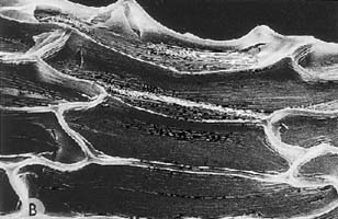 testa cells, showing junction of cells and striations on their surface (magnification x360)