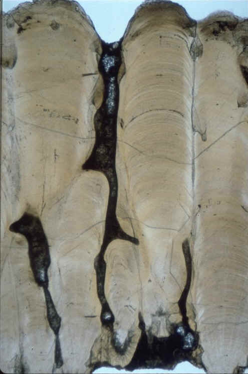 Oeuf de Dinosaure Megaloolithus siruguei, Rognacien moyen de Rousset-sur-Arc ( Bouches -du-Rhne , France ), section radiale, auteur: Kerourio , reproduction interdite.jpg (70430 octets)