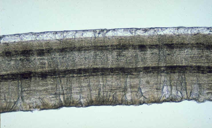 Prismatoolithus bandes colorees sec radiale.jpg (85717 octets)