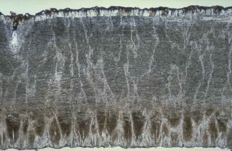 oeuf de type ratite , type non d�crit , Rognacien sup�rieur de la r�gion d'Aix-en-Provence , section radiale en lumi�re naturelle , auteur : Ph.Kerourio , reproduction interdite .jpg (107726 octets)