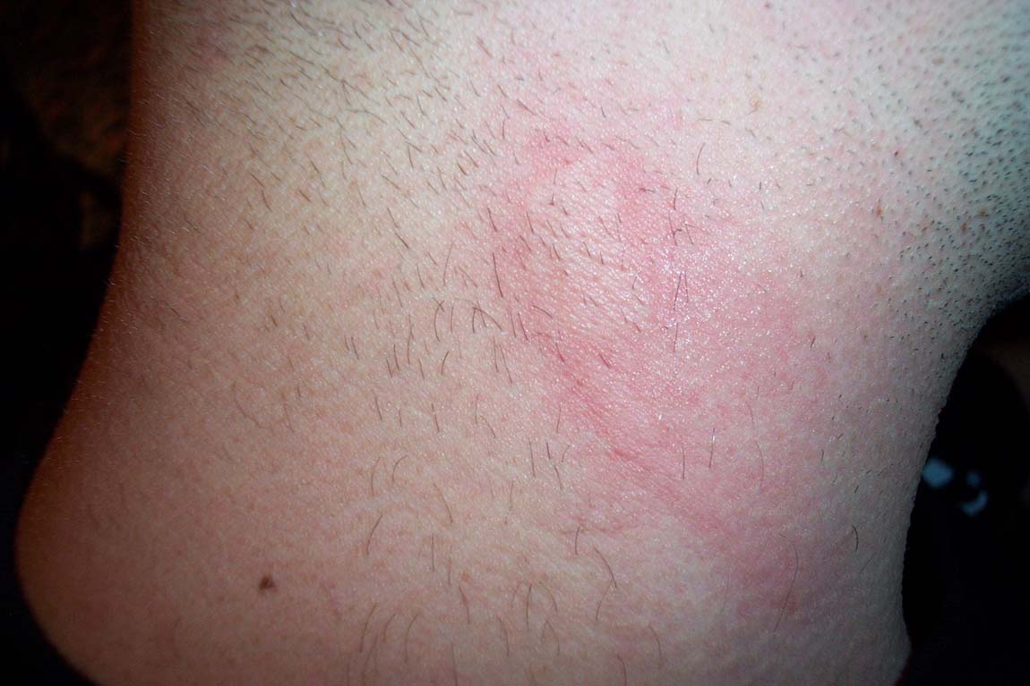 OW!!!!