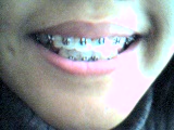 METAL MOUTH
