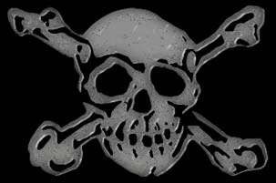 Bones
