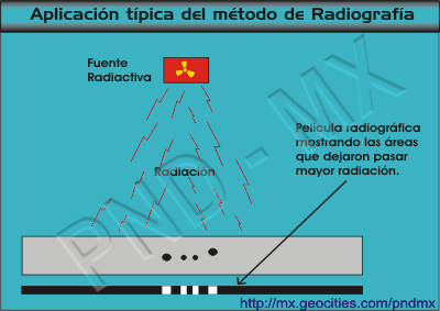 Aplicaci�n de radiograf�a