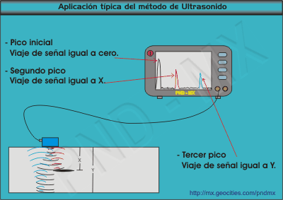 Aplicaci�n del Ultrasonido