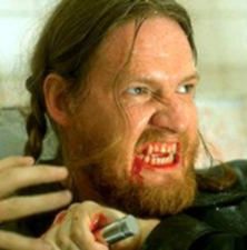 Donal is stricken with severe gingivitis in 'Blade'