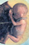 bebe14semanas.jpg (35202 bytes)