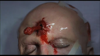problema facial