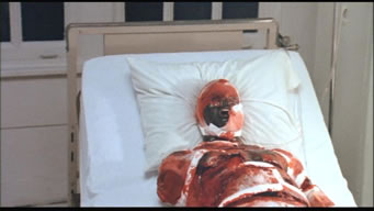hospitalizado