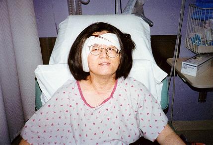 Post-op Picture