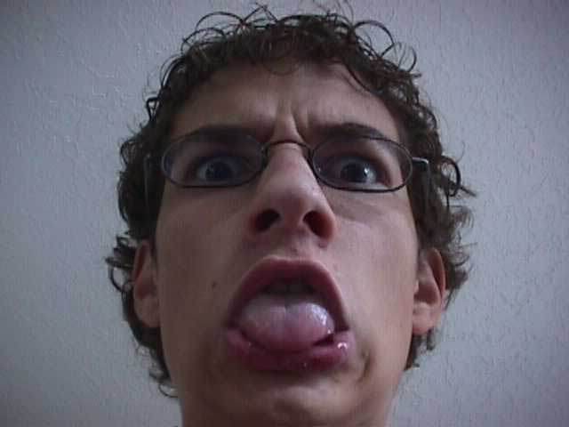 Gross!!! Just look at that kid! Its nasty!!!