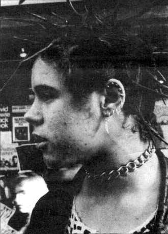 Peter Mortiboys fighting 2 of punks biggest enemies...Rolls Royce victimization & Acne! (DC Collection)
