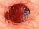 A BedBug on Human Skin