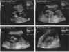baby_Raad.jpg (42122 bytes)