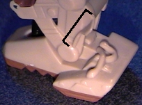 Left leg, 'before' example