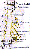 OBPlesn.gif (81121 bytes)