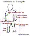 nrvgrft.gif (41657 bytes)