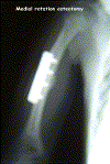 obp.shldr1.1.gif (104830 bytes)
