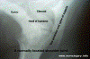 xrayshldr.gif (110077 bytes)