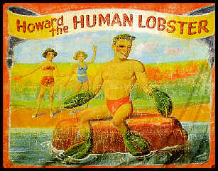 The world-famous Lobster Boy!