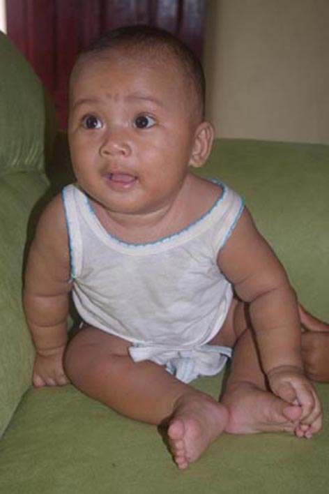GALERY