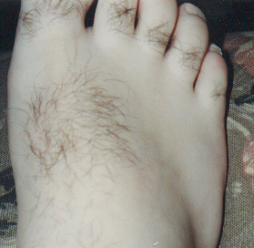 ewwww hairy foot.