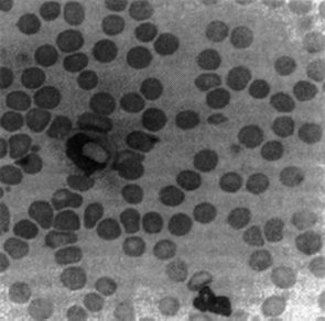hepatozoon.jpg (19084 bytes)