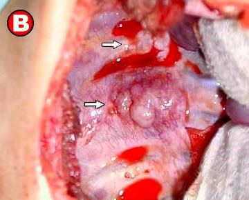 tesla laddstationer europa pleural mesothelioma clinical trials
