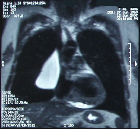 Sintulo10