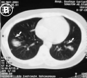 Corte tomografico B