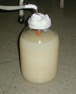 Secci�n del ligamento triangular