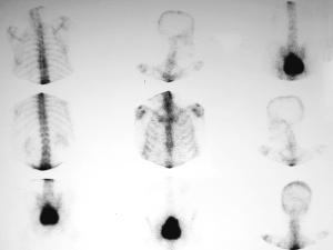 Ganmagrama oseo - craneo - cuello - torax - abdomen- pelvis