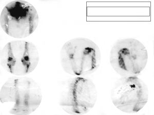 Ganmagrama oseo - miembros