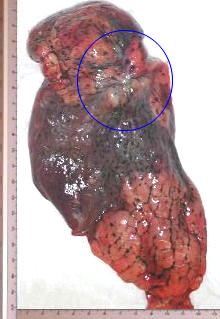 Fotografia de la pieza resecada