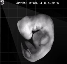 Human Embryo