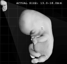 Embryo 48 days