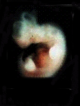 Rat Embryo
