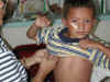 Jose Dresses for Hospital.jpg (120749 bytes)