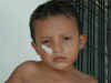 Jose Elias Mejia Bandaged.jpg (126759 bytes)
