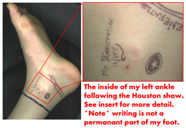 my 'injury'