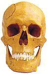 The skull of a Roman soldier who was killed and dumped in a well with 135 kilos of rocks on top of him (Velsen, the Netherlands)