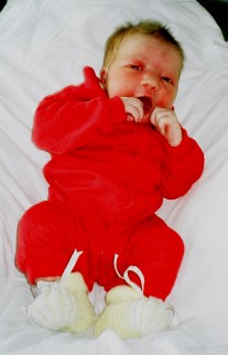 Baby with blue eyes, blonde hair, flaky skin and a bit red.
