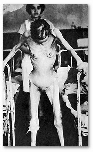 Hospital Victim of Dachau