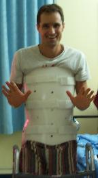 Picture taken on 2nd day of walking, 9 days after injury