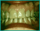 #2 Before