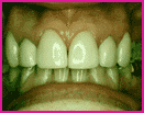 #2 After