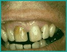 #5 Before
